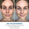 imageWake Up Radiant AHA Peel  Gentle Resurfacer Visibly Brightens Dark Spots Smooths the Look of Rough Skin ampamp Visibly Firms Lines Great For All Skin Types