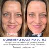 imagegoPure Actives Firm ampamp Lift Serum  AntiAging Serum with Retinol for more Smooth EvenTexture and Glowing Skin and Antioxidant Bakuchiol for Collagen Support and FirmerLooking Skin  1 fl oz