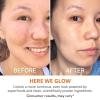 imagegoPure Actives Vitamin C Serum  Brightening Serum with Vitamin C and Ferulic Acid Face Moisturizing and AntiAging Benefits Improves Skin Discoloration and Visibly Reduces Dark Spots  1 fl oz