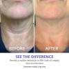imagegoPure Sculpting Duo  Tighten ampamp Lift Neck Cream Sculpt ampamp Tone Arm Cream 2 Piece Set2 Pack