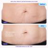 imagegoPure Tighten ampamp Smooth Belly Cream  Clinically Tested