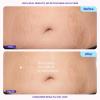 imagegoPure Tighten ampamp Smooth Belly Cream  Clinically Tested
